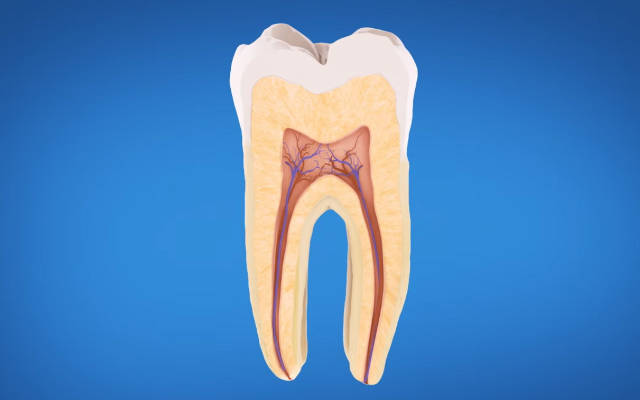 Tratamento de Canal de Dente: Perguntas e Respostas